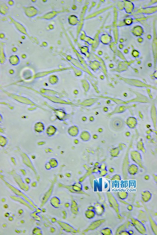 <p>    ↑目前臨床應(yīng)用最廣泛的細(xì)胞生物治療是C IK細(xì)胞治療，在顯微鏡下可清晰看到D C細(xì)胞(葉片形狀)和C IK細(xì)胞(圓點(diǎn)形狀)。</p>